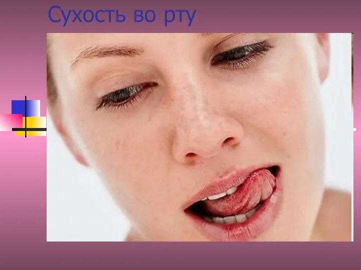 Сухость во рту