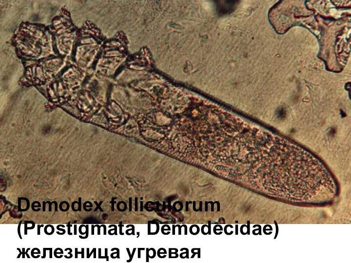 Demodex folliculorum (Prostigmata, Demodecidae) железница угревая
