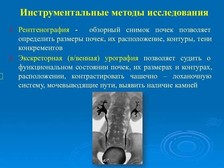 Инструментальные методы исследования Рентгенография - обзорный снимок почек позволяет определить размеры почек,