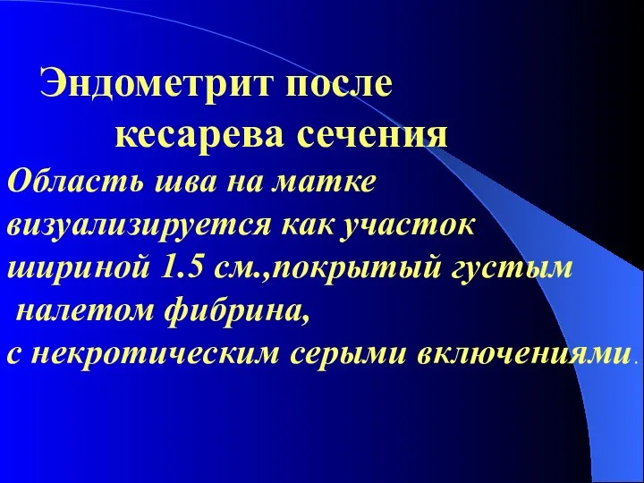 Эндометрит после кесарева сечения Область шва на матке визуализируется как участок шириной