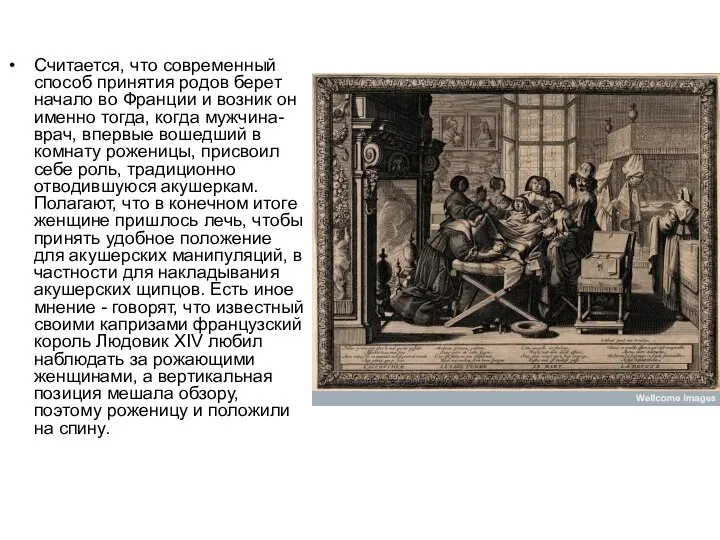 Считается, что современный способ принятия родов берет начало во Франции и возник