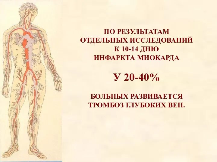 ПО РЕЗУЛЬТАТАМ ОТДЕЛЬНЫХ ИССЛЕДОВАНИЙ К 10-14 ДНЮ ИНФАРКТА МИОКАРДА У 20-40% БОЛЬНЫХ РАЗВИВАЕТСЯ ТРОМБОЗ ГЛУБОКИХ ВЕН.