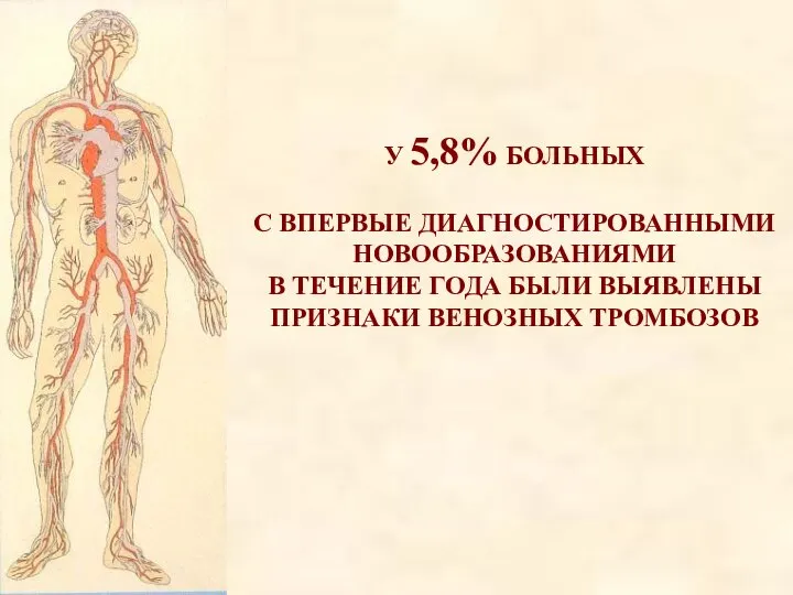 У 5,8% БОЛЬНЫХ С ВПЕРВЫЕ ДИАГНОСТИРОВАННЫМИ НОВООБРАЗОВАНИЯМИ В ТЕЧЕНИЕ ГОДА БЫЛИ ВЫЯВЛЕНЫ ПРИЗНАКИ ВЕНОЗНЫХ ТРОМБОЗОВ