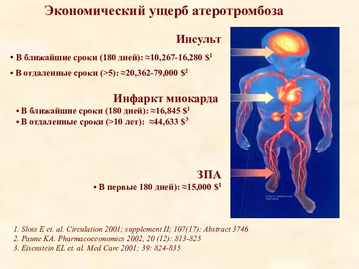 Инсульт В ближайшие сроки (180 дней): ≈10,267-16,280 $1 В отдаленные сроки (>5):