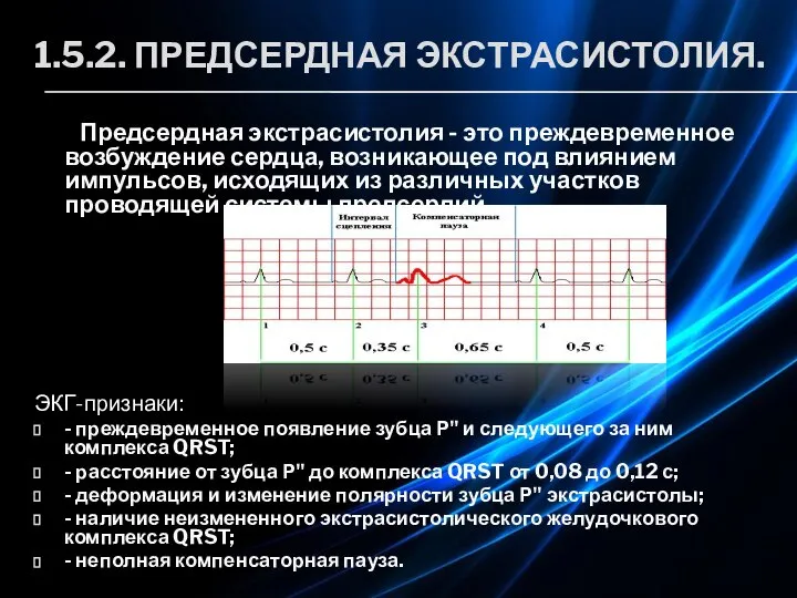 1.5.2. ПРЕДСЕРДНАЯ ЭКСТРАСИСТОЛИЯ. Предсердная экстрасистолия - это преждевременное возбуждение сердца, возникающее под