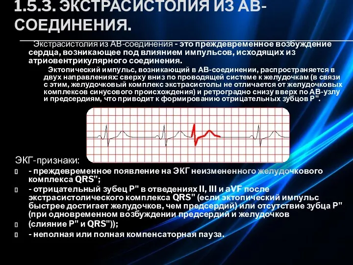 1.5.3. ЭКСТРАСИСТОЛИЯ ИЗ АВ-СОЕДИНЕНИЯ. Экстрасистолия из АВ-соединения - это преждевременное возбуждение сердца,