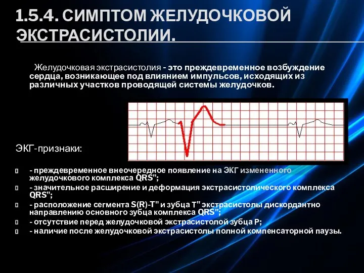 1.5.4. СИМПТОМ ЖЕЛУДОЧКОВОЙ ЭКСТРАСИСТОЛИИ. Желудочковая экстрасистолия - это преждевременное возбуждение сердца, возникающее