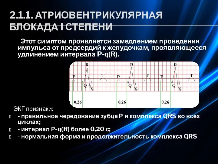 2.1.1. АТРИОВЕНТРИКУЛЯРНАЯ БЛОКАДА I СТЕПЕНИ Этот симптом проявляется замедлением проведения импульса от