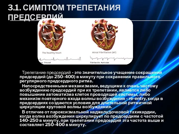 3.1. СИМПТОМ ТРЕПЕТАНИЯ ПРЕДСЕРДИЙ. Трепетание предсердий - это значительное учащение сокращений предсердий