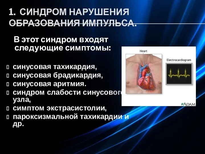 1. СИНДРОМ НАРУШЕНИЯ ОБРАЗОВАНИЯ ИМПУЛЬСА. В этот синдром входят следующие симптомы: синусовая