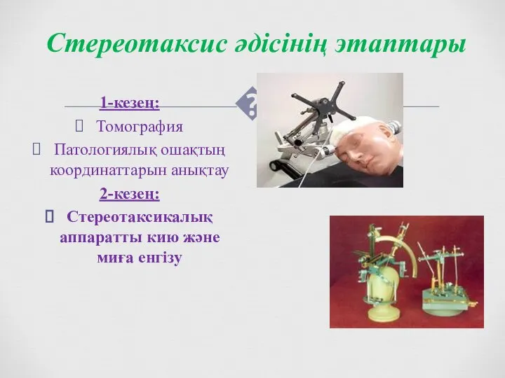 Стереотаксис әдісінің этаптары 1-кезең: Томография Патологиялық ошақтың координаттарын анықтау 2-кезең: Стереотаксикалық аппаратты кию және миға енгізу