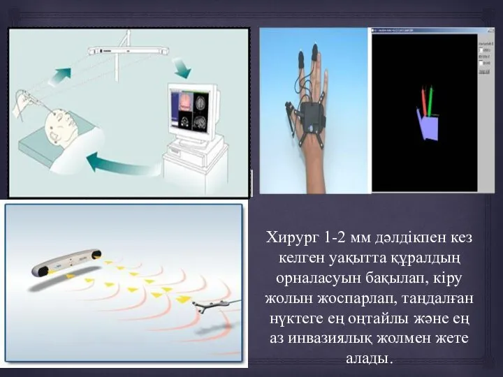 Хирург 1-2 мм дәлдікпен кез келген уақытта құралдың орналасуын бақылап, кіру жолын