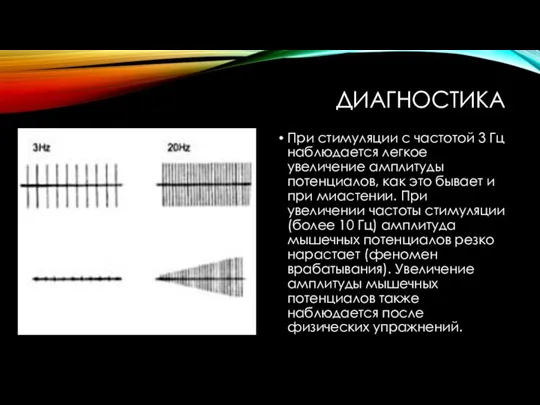 ДИАГНОСТИКА При стимуляции с частотой 3 Гц наблюдается легкое увеличение амплитуды потенциалов,