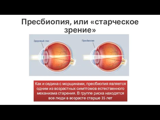 Пресбиопия, или «старческое зрение» Как и седина с морщинами, пресбиопия является одним