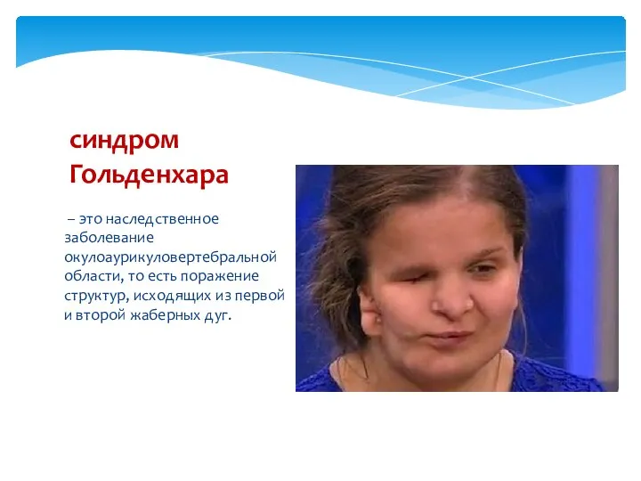 – это наследственное заболевание окулоаурикуловертебральной области, то есть поражение структур, исходящих из