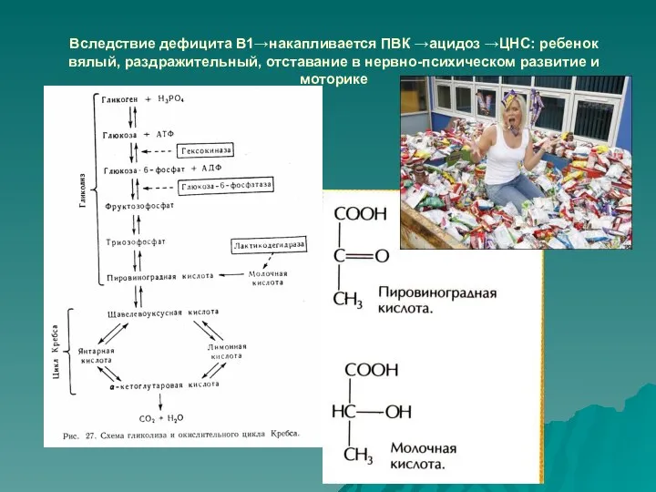 Вследствие дефицита В1→накапливается ПВК →ацидоз →ЦНС: ребенок вялый, раздражительный, отставание в нервно-психическом развитие и моторике