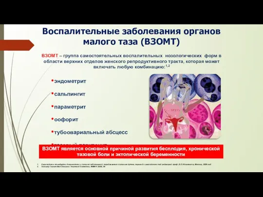 Воспалительные заболевания органов малого таза (ВЗОМТ) Европейские стандарты диагностики и лечения заболеваний,