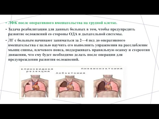 ЛФК после оперативного вмешательства на грудной клетке. Задача реабилитации для данных больных