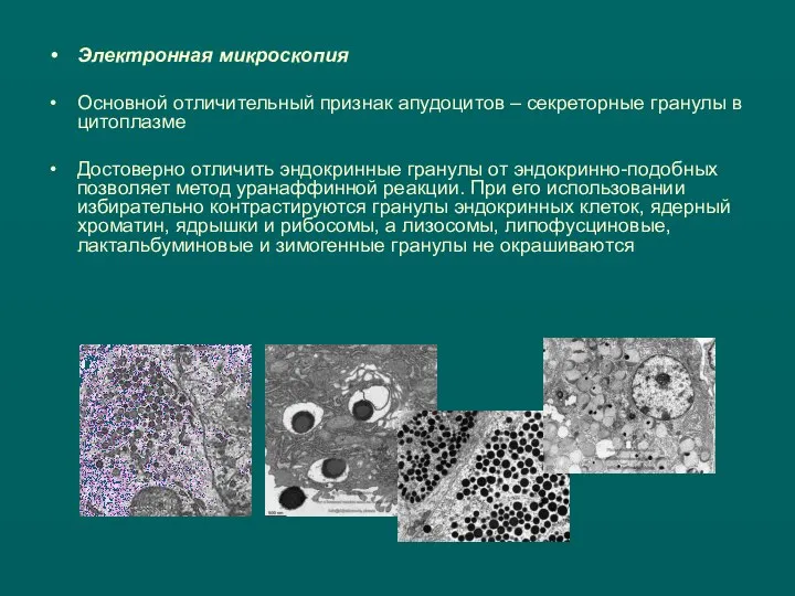 Электронная микроскопия Основной отличительный признак апудоцитов – секреторные гранулы в цитоплазме Достоверно