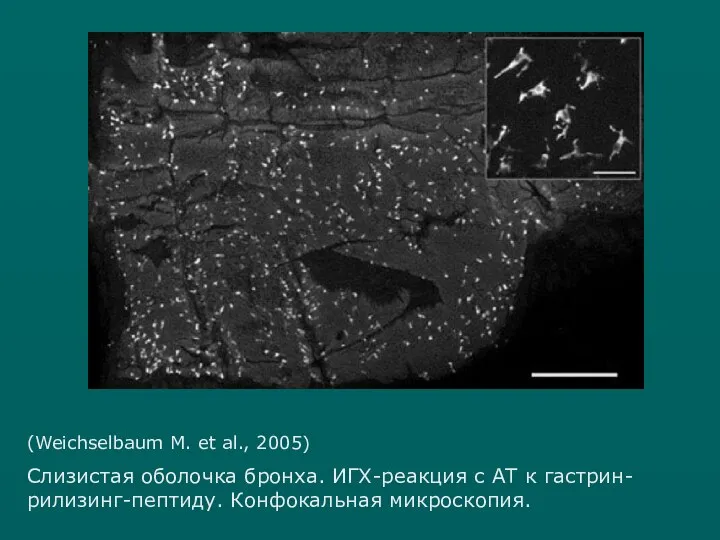 (Weichselbaum M. et al., 2005) Слизистая оболочка бронха. ИГХ-реакция с АТ к гастрин-рилизинг-пептиду. Конфокальная микроскопия.