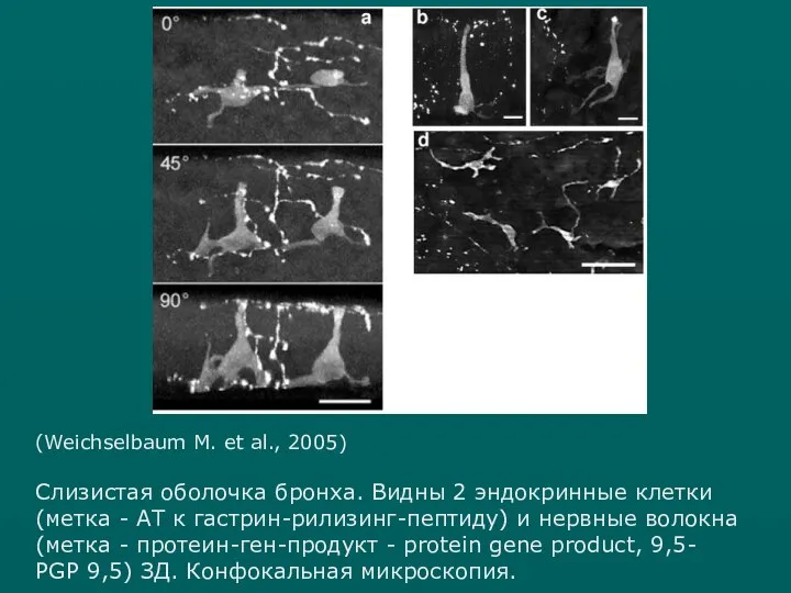 (Weichselbaum M. et al., 2005) Слизистая оболочка бронха. Видны 2 эндокринные клетки