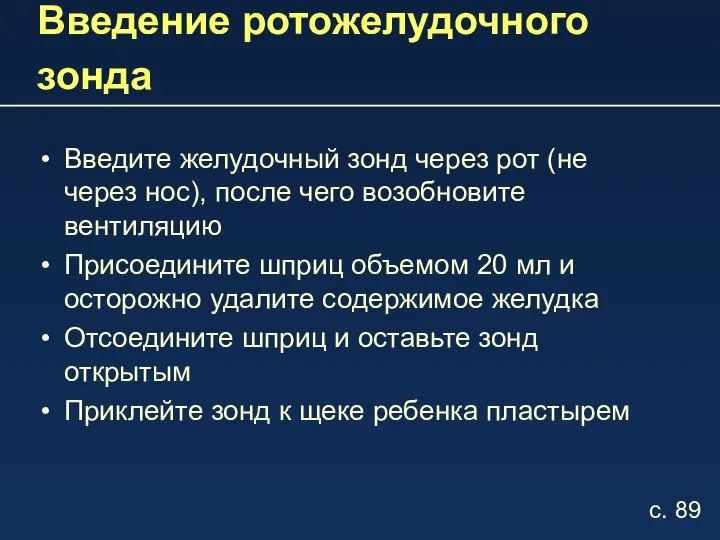 Введение ротожелудочного зонда Введите желудочный зонд через рот (не через нос), после