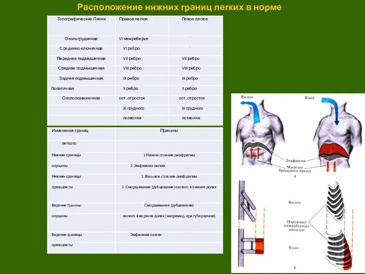 Расположение нижних границ легких в норме