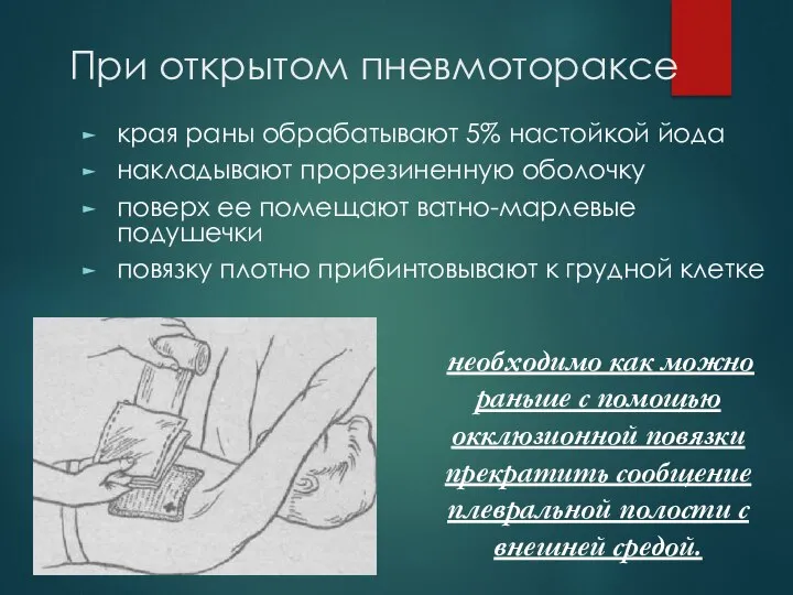 При открытом пневмотораксе края раны обрабатывают 5% настойкой йода накладывают прорезиненную оболочку