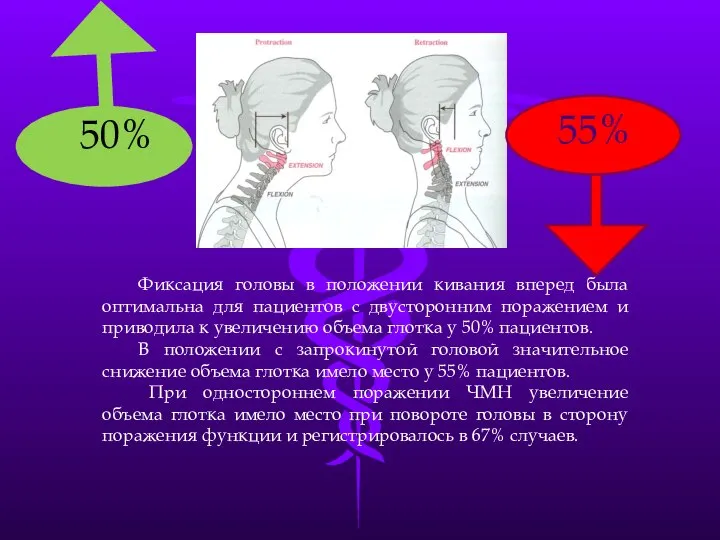 Фиксация головы в положении кивания вперед была оптимальна для пациентов с двусторонним