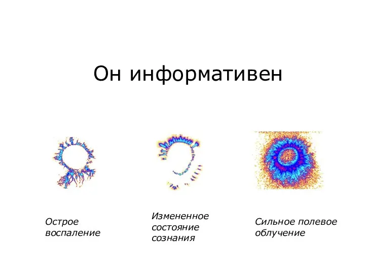 Он информативен Сильное полевое облучение Измененное состояние сознания Острое воспаление