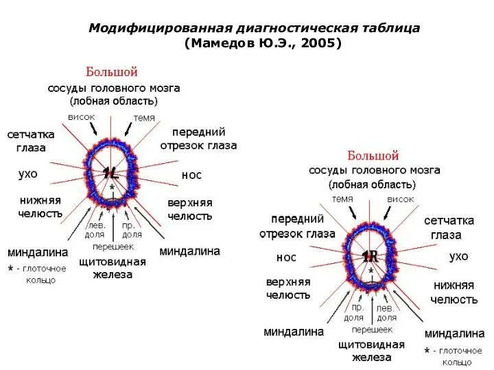 Модифицированная диагностическая таблица (Мамедов Ю.Э., 2005)