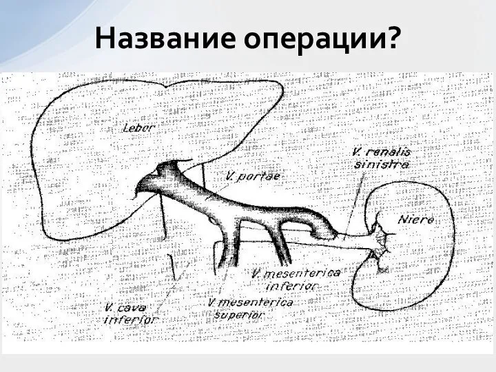 Название операции?