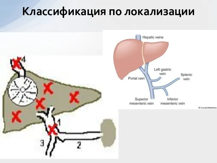 Классификация по локализации