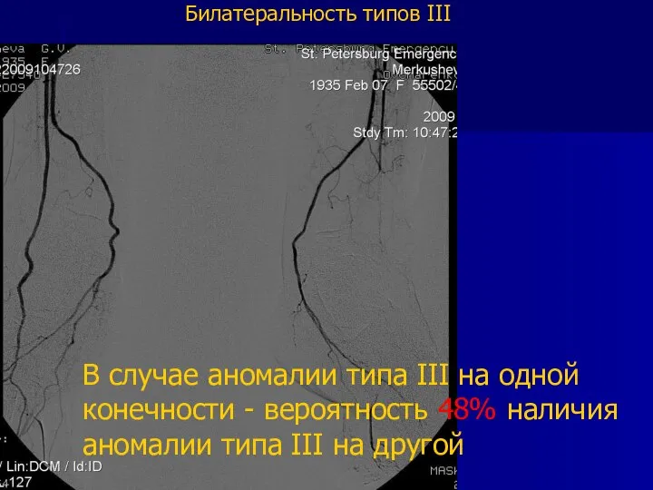 Билатеральность типов III В случае аномалии типа III на одной конечности -