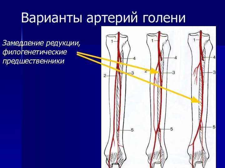 Варианты артерий голени Замедление редукции, филогенетические предшественники