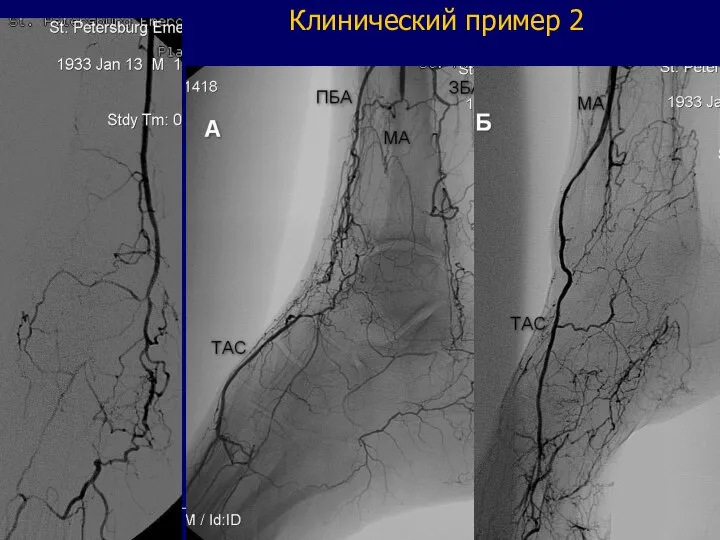 Клинический пример 2