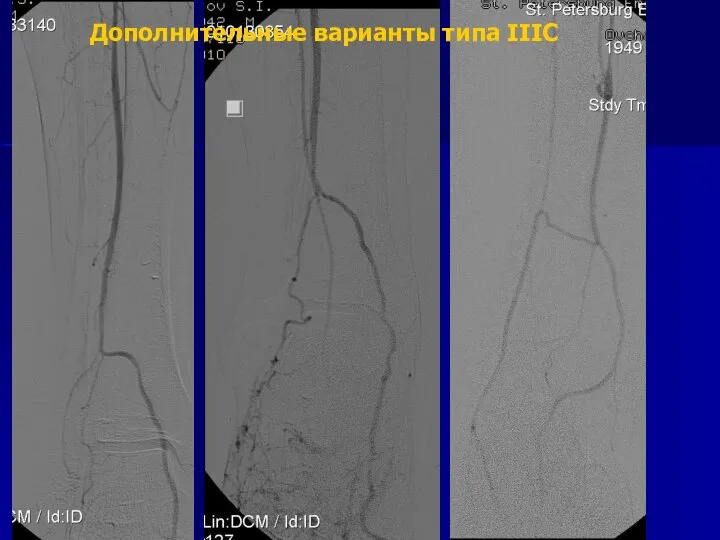 Дополнительные варианты типа IIIC