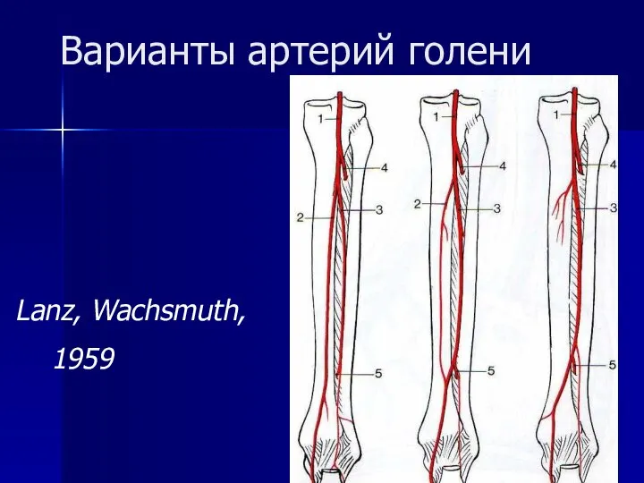 Варианты артерий голени Lanz, Wachsmuth, 1959