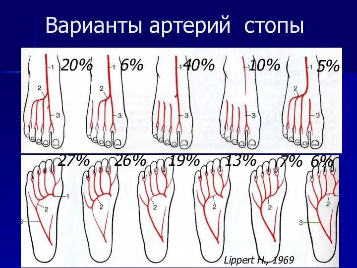 Варианты артерий стопы 20% 6% 40% 10% 5% Lippert H., 1969 27%