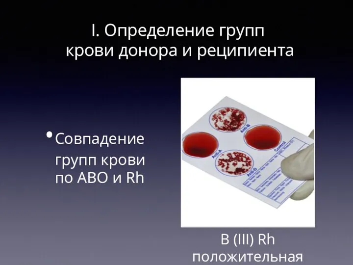 I. Определение групп крови донора и реципиента Совпадение групп крови по АВО