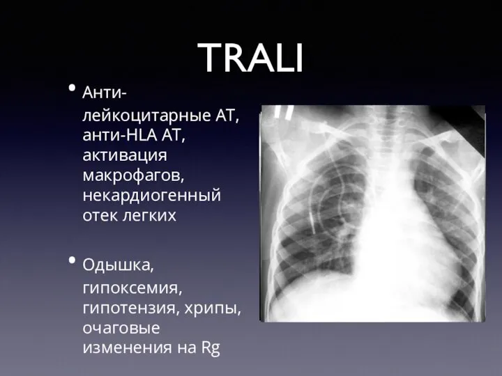 TRALI Анти-лейкоцитарные АТ, анти-HLA AT, активация макрофагов, некардиогенный отек легких Одышка, гипоксемия,