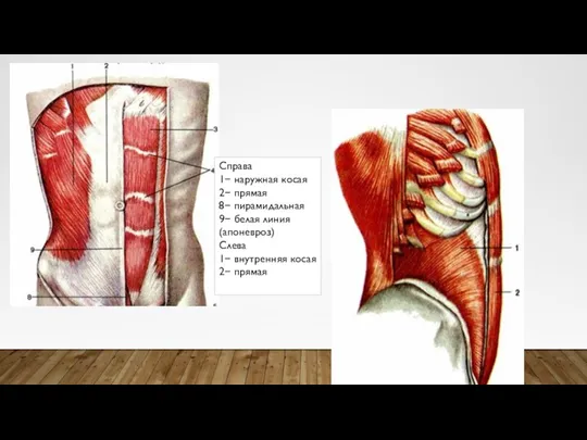 Справа 1− наружная косая 2− прямая 8− пирамидальная 9− белая линия (апоневроз)