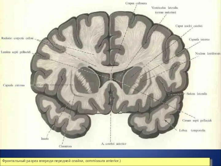 Фронтальный разрез впереди передней спайки, commissura anterior.)