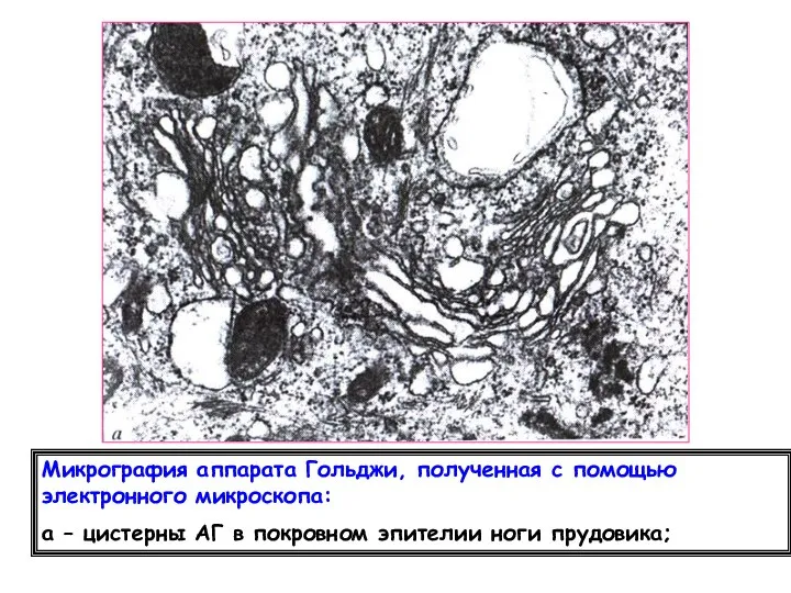 Микрография аппарата Гольджи, полученная с помощью электронного микроскопа: а – цистерны АГ