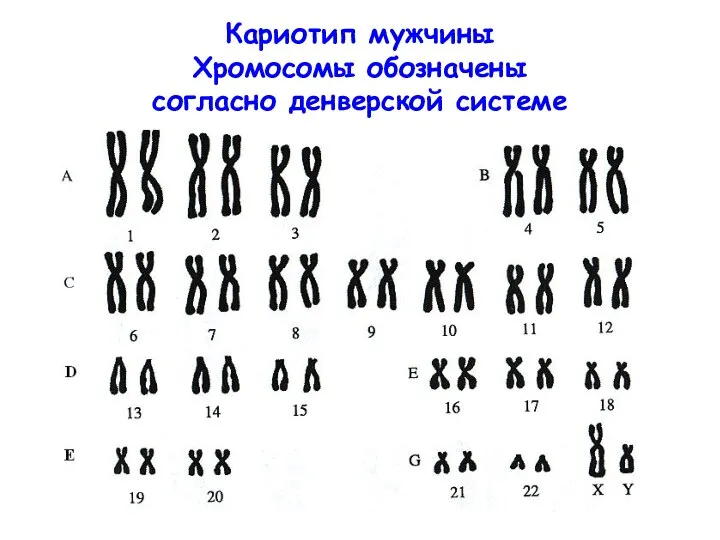 Кариотип мужчины Хромосомы обозначены согласно денверской системе