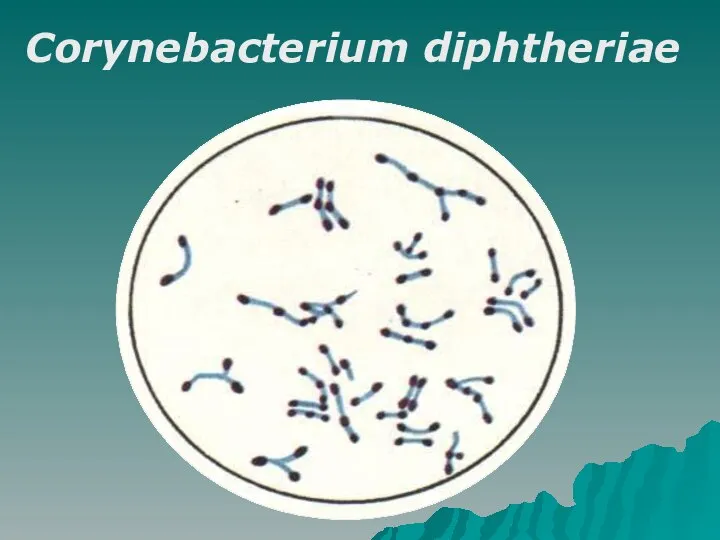 Corynebacterium diphtheriae