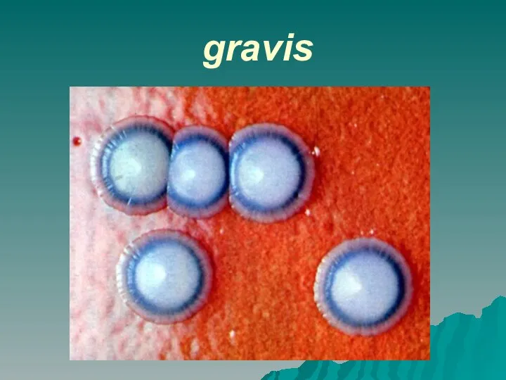 gravis