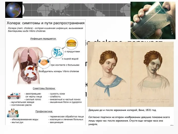 Холера Возбудитель – Vibrio cholerae, поражает тонкий кишечник Возникает при употреблении некипяченой