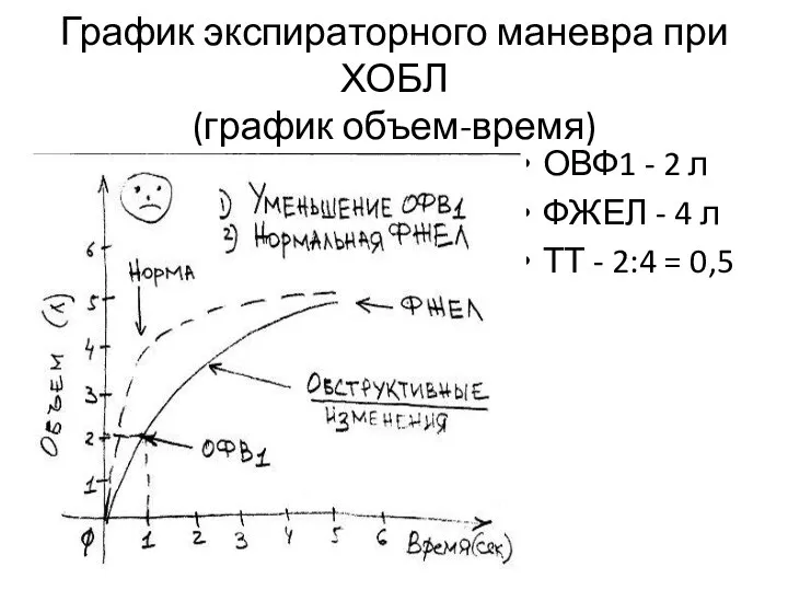 График экспираторного маневра при ХОБЛ (график объем-время) ОВФ1 - 2 л ФЖЕЛ