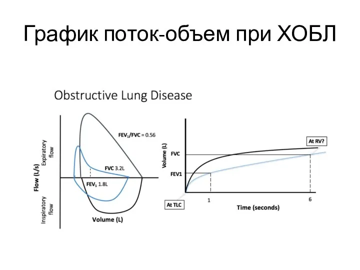 График поток-объем при ХОБЛ